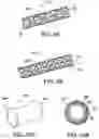 Fig. 05 - Implantable medical devices, and methods of delivering the same