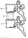 Fig. 01 - Skeletal reconstruction cages