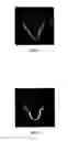 Fig. 03 - Method for designing 3-dimensional porous tissue engineering scaffold
