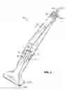 Fig. 02 - Spot removal device
