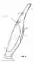 Fig. 09 - Spot removal device