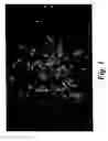 Fig. 02 - Pharmaceutical kits comprising mesenchymal stem cells