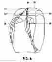 Fig. 07 - Backpack with shoulder movement harness system