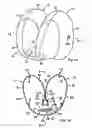 Fig. 02 - Airbag and aribag system