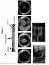 Fig. 02 - Three dimensional bioengineered smooth muscle tissue and sphincters and methods therefor