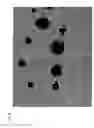 Fig. 07 - Method for producing retinal neurocyte from neural stem cell derived from iris tissue