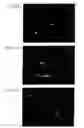 Fig. 08 - Method for producing retinal neurocyte from neural stem cell derived from iris tissue