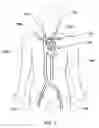 Fig. 02 - Expandable trans-septal sheath