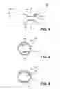 Fig. 02 - Vulnerable plaque modification methods and apparatuses