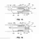 Fig. 06 - Vulnerable plaque modification methods and apparatuses
