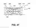 Fig. 22 - Vulnerable plaque modification methods and apparatuses