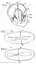 Fig. 02 - Surgical device for connecting soft tissue