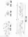 Fig. 04 - Barbed Suture in Combination with Surgical Needle