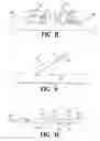 Fig. 06 - Barbed Suture in Combination with Surgical Needle