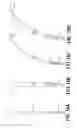 Fig. 09 - Barbed Suture in Combination with Surgical Needle