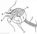 Fig. 01 - Medical device and method for temperature control and treatment of the eye and surrounding tissues