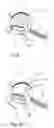 Fig. 06 - Medical device and method for temperature control and treatment of the eye and surrounding tissues