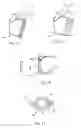 Fig. 09 - Medical device and method for temperature control and treatment of the eye and surrounding tissues