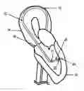 Fig. 01 - Intra-ventricular substance delivery catheter system