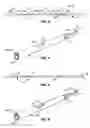Fig. 03 - Coiled stent delivery system and method