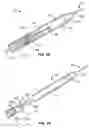 Fig. 09 - Delivery catheter and method