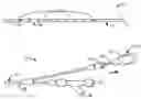 Fig. 01 - Coiled endoluminal prosthesis system and delivery catheter
