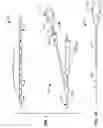 Fig. 02 - Coiled endoluminal prosthesis system and delivery catheter