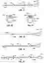 Fig. 06 - Coiled endoluminal prosthesis system and delivery catheter