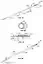 Fig. 08 - Coiled endoluminal prosthesis system and delivery catheter