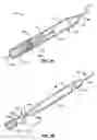 Fig. 09 - Coiled endoluminal prosthesis system and delivery catheter