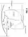 Fig. 07 - Longitudinal design and improved material for flexible connectors in high strength, high flexibility, controlled recoil stent