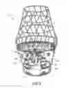 Fig. 04 - Medical device with bioactive agent