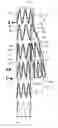 Fig. 01 - Stented side branch graft