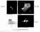 Fig. 07 - Patient specific anatomically correct implants to repair or replace hard or soft tissue