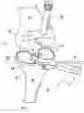 Fig. 01 - Tibial tray inserter