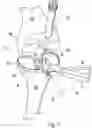 Fig. 06 - Tibial tray inserter