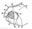 Fig. 01 - Batting pad for protecting a batter's hand