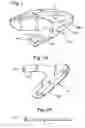 Fig. 02 - Coupling device for restraining belts, particularly for children's safety seats for motor vehicles