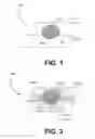 Fig. 02 - Tear film osmometry