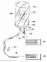 Fig. 01 - Normobaric infection control