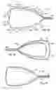 Fig. 04 - Ventricular restoration shaping apparatus and method of use