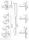 Fig. 07 - Ventricular restoration shaping apparatus and method of use