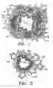Fig. 02 - Methods for treating airways