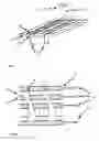 Fig. 02 - Nanoelectrode device for chemical analysis
