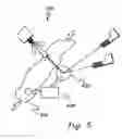 Fig. 09 - In-situ X-ray diffraction system using sources and detectors at fixed angular positions