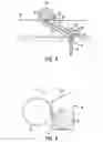 Fig. 08 - Retainer assembly including buoyant retainer attached to remediation material and anchor