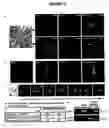 Fig. 04 - Regeneration initiating cells