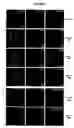 Fig. 07 - Regeneration initiating cells