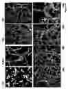Fig. 16 - Repairing or replacing tissues or organs
