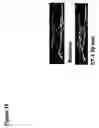 Fig. 20 - Repairing or replacing tissues or organs